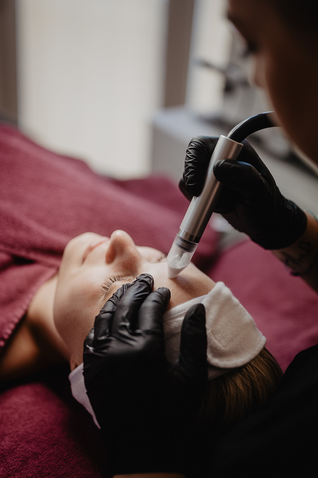 Detail der REVIDERM Mikrodermabrasion