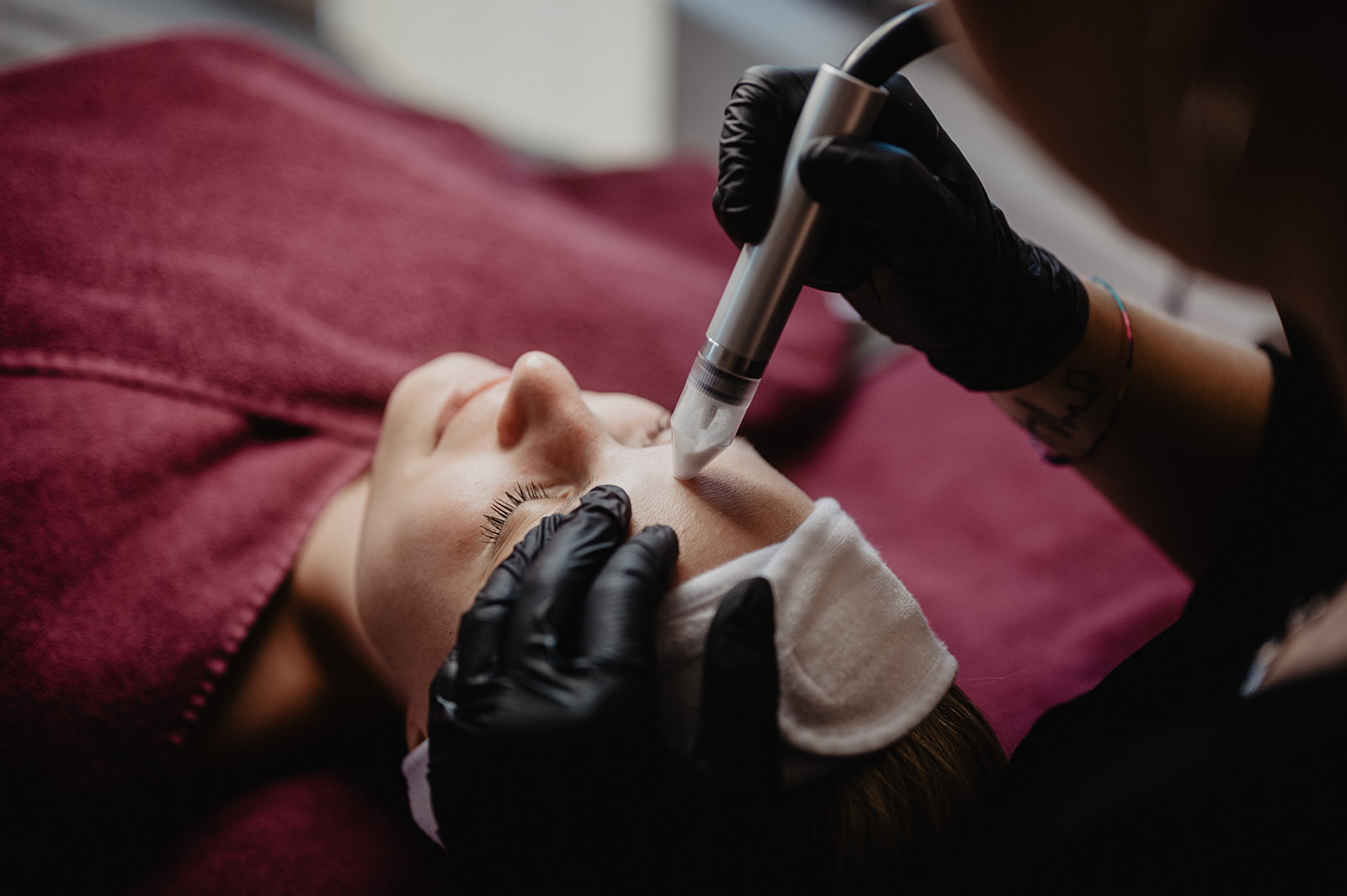 REVIDERM Mikrodermabrasion Behandlung bei Hauptsache Schön